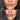 Extreme Lip Plumper – Instant Volume Without Fillers - UYKUM